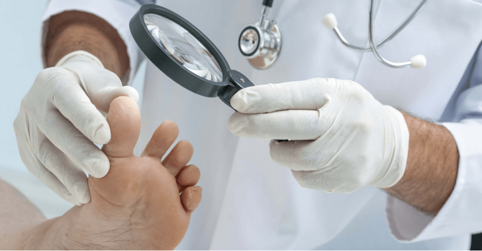 The first symptoms of the fungus of the legs
